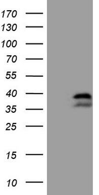 hHR23b (RAD23B) antibody
