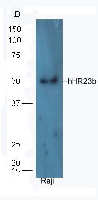 hHR23b antibody