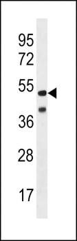 HHV14 UL38 antibody