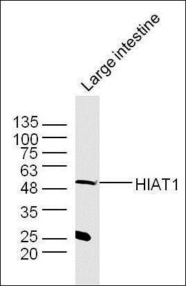 HIAT1 antibody