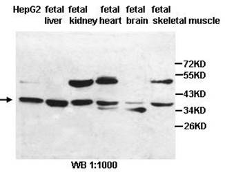 HIBCH Rabbit Polyclonal Antibody