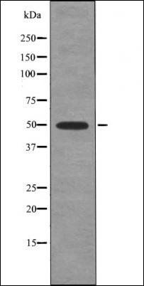 Hic-5 (Phospho-Tyr60) antibody