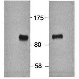 Goat anti-HIC1 (aa193-204) Antibody