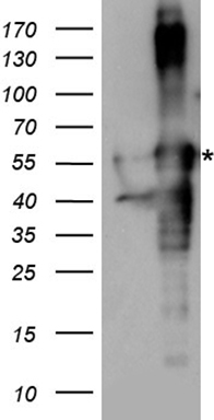 HIC5 (TGFB1I1) antibody