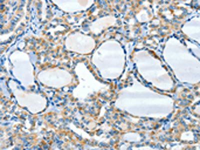 HID1 Antibody