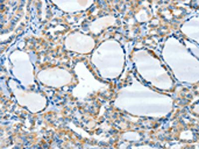 HID1 antibody