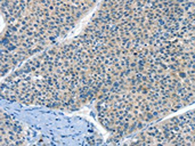 HID1 Antibody