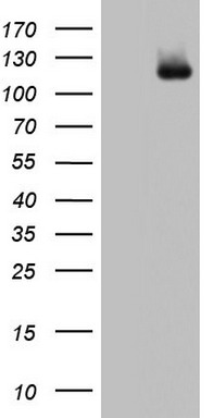 HIF 2 alpha (EPAS1) antibody