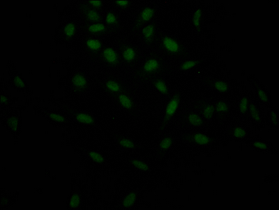 HIF1A Recombinant Monoclonal Antibody