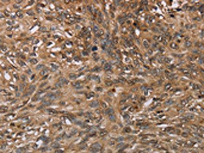 HIF1AN Antibody