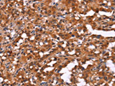 HINT1 Antibody