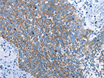 HINT2 Antibody