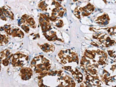 HINT2 Antibody