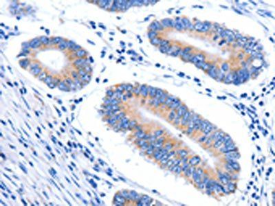 HINT2 Antibody