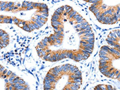 HINT2 Antibody