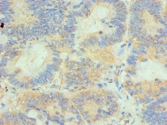 HIP1 Antibody
