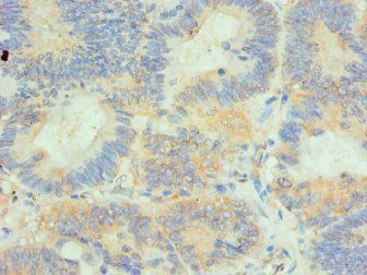 HIP1 antibody