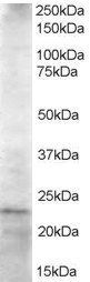 Goat anti-HIP2 Antibody