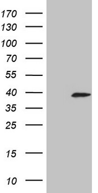 HIP55 (DBNL) antibody