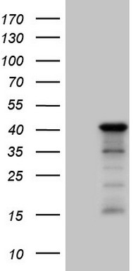 HIP55 (DBNL) antibody
