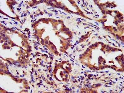 HIPK1 Antibody