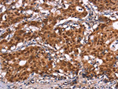 HIPK1 Antibody