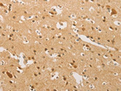 HIPK4 Antibody
