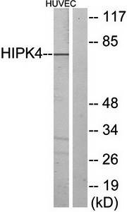 HIPK4 antibody