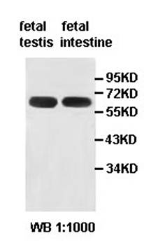 HIRIP3 Rabbit Polyclonal Antibody