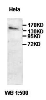 HISPPD1 Rabbit Polyclonal Antibody