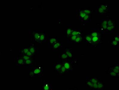 HIST1H1A (Ab-21) Antibody