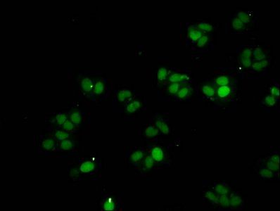 HIST1H1A (Ab-21) antibody