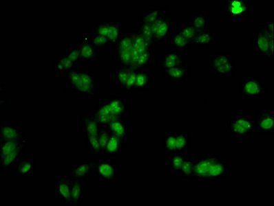 HIST1H1A (Ab-21) antibody