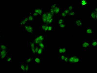 HIST1H1A (Ab-21) Antibody