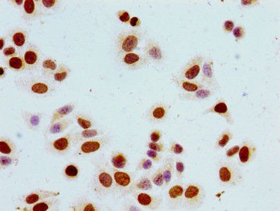 Phospho-HIST1H1B (S17) Antibody