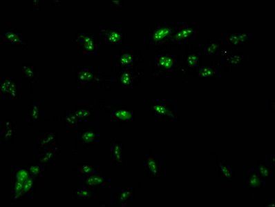 HIST1H1D (Ab-16) Antibody