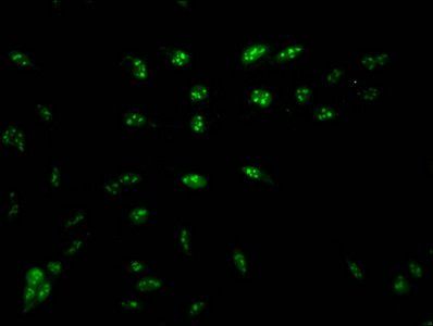 HIST1H1D (Ab-16) antibody