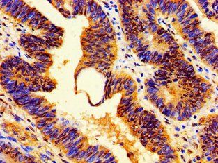 HIST1H1E (Ab-3) Antibody