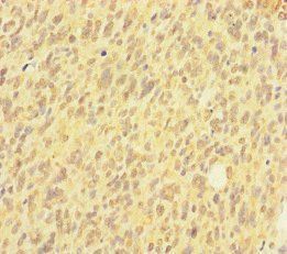 HIST1H2AB Antibody