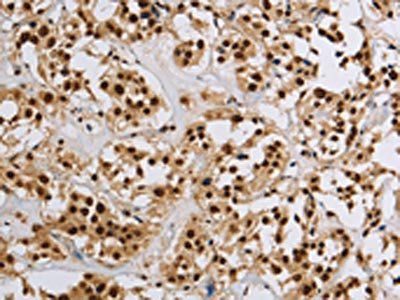 HIST1H2AB Antibody