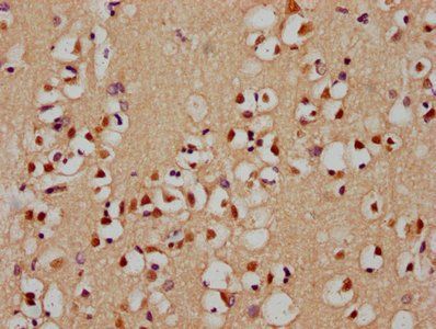 HIST1H2AC Antibody
