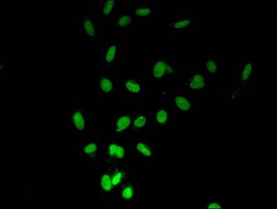 HIST1H2BB (Ab-16) antibody