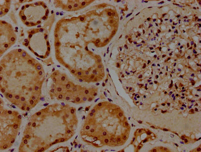 HIST1H2BL antibody