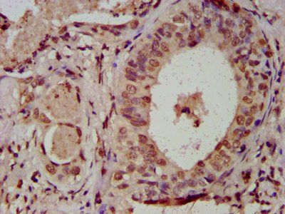 HIST1H3A (Ab-122) Antibody