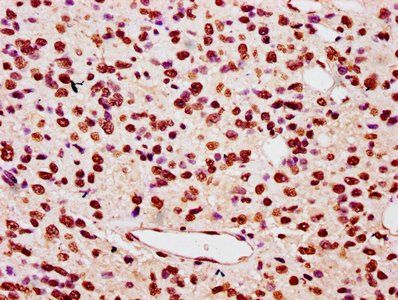 HIST1H3A (Ab-122) Antibody