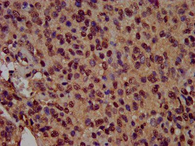 HIST1H3A (Ab-14) Antibody