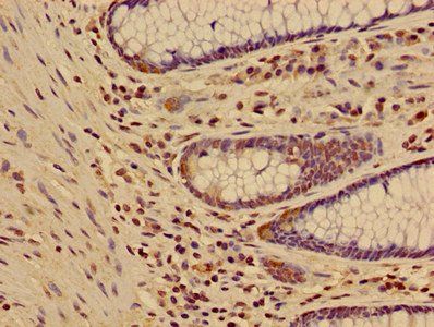 HIST1H3A (Ab-17) antibody