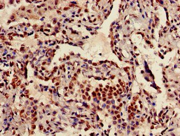 HIST1H3A (Ab-18) Antibody