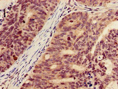 HIST1H3A (Ab-18) Antibody