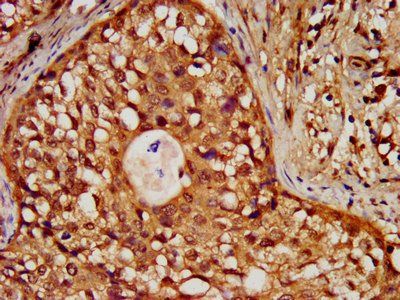HIST1H3A (Ab-18) Antibody